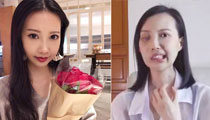 女星患癌致五官变形