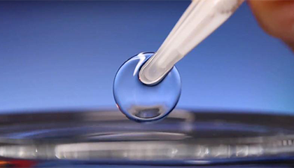 25岁男子半年未取隐形眼镜