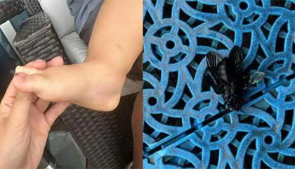 婆孙泳池边被毒虫咬伤