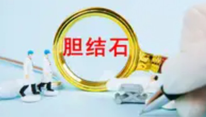 当心结石变癌