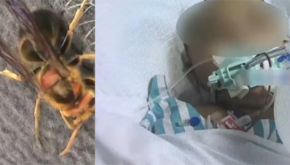 重庆一家3口爬山遭马蜂袭击