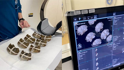 蟹黄多不多都用CT检查了