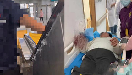 扶手侧面钢板缝隙未焊接