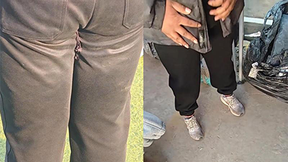 老师课间操看到学生裤子磨破