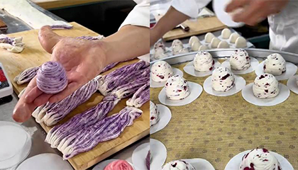 27岁小伙患先天性巨指症