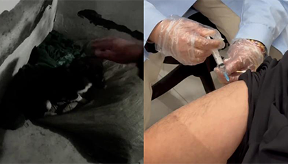 被自家宠物狗咬未注意