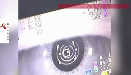 视力突然从1.0掉到0.2