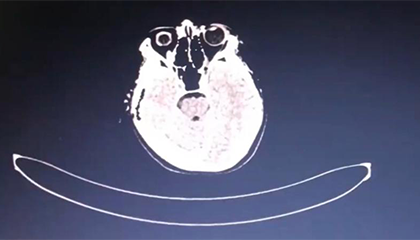 13岁男孩澡堂泡澡20分钟后