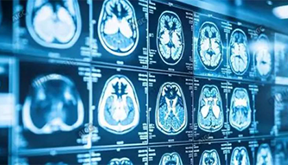 23岁小伙出差后呕吐腹泻4天