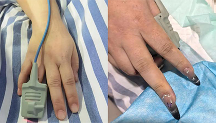 28岁女子心跳骤停