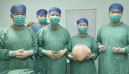 女子没怀孕肚子却越来越大