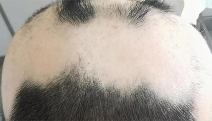 长期报复性熬夜打游戏刷视频