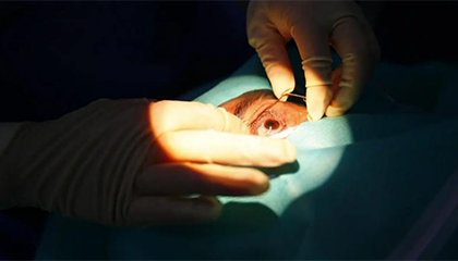 男子长针眼当痘挤